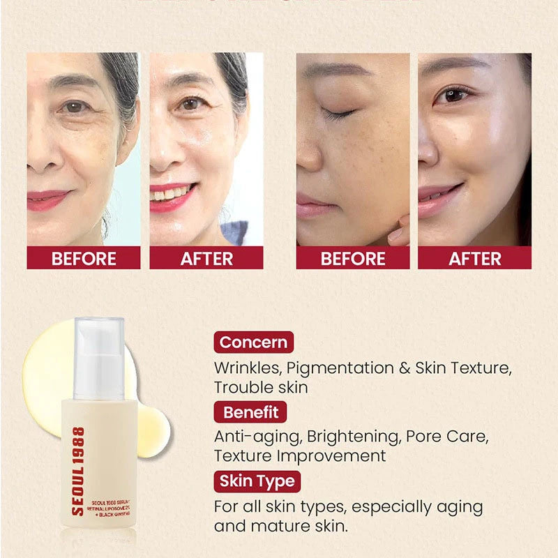 Seoul 1988 Eye Cream Gentle Moisturizing Lighten Fine Lines Essence Niacinamide Retinoic Acid Ginseng Essence Charm Eye Cream